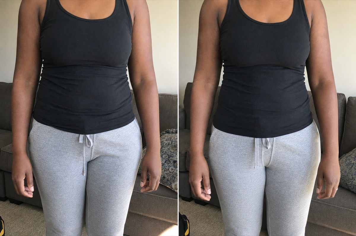 before and after
